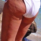 cellulitis behandelen